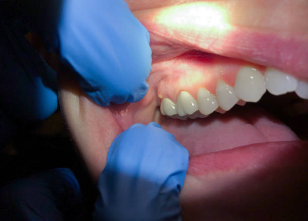 Best Mobile Emergency Dentist in Norwood, OH