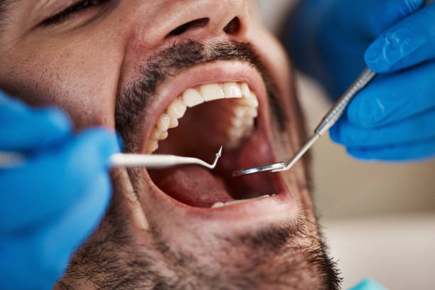 Best Broken or Cracked Tooth Emergency Dentist in Norwood, OH
